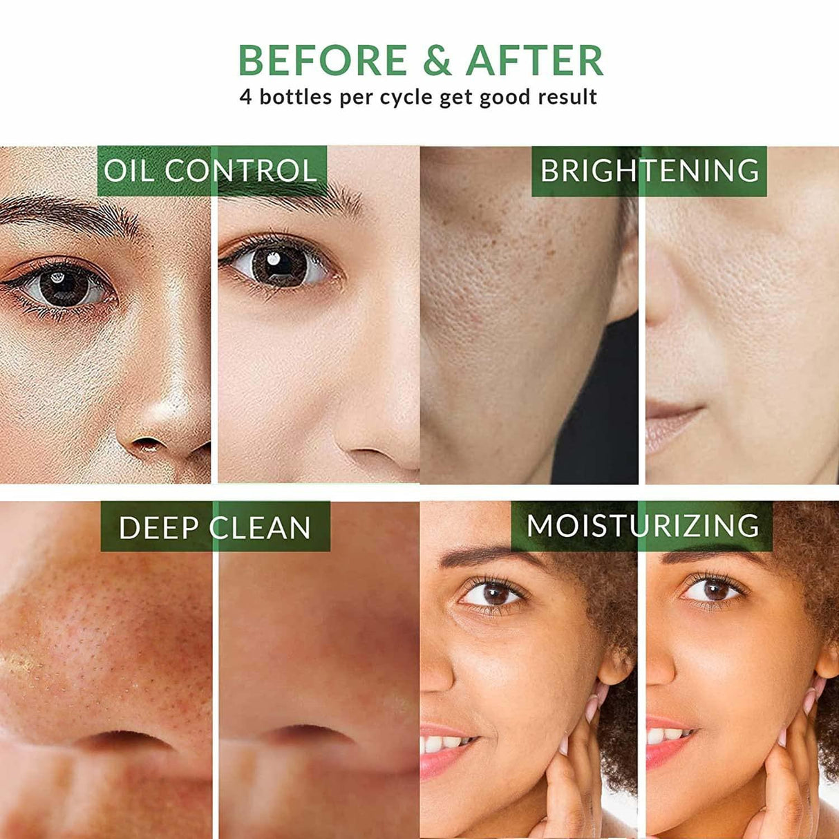 Before and after effects of a skincare product on various skin types.