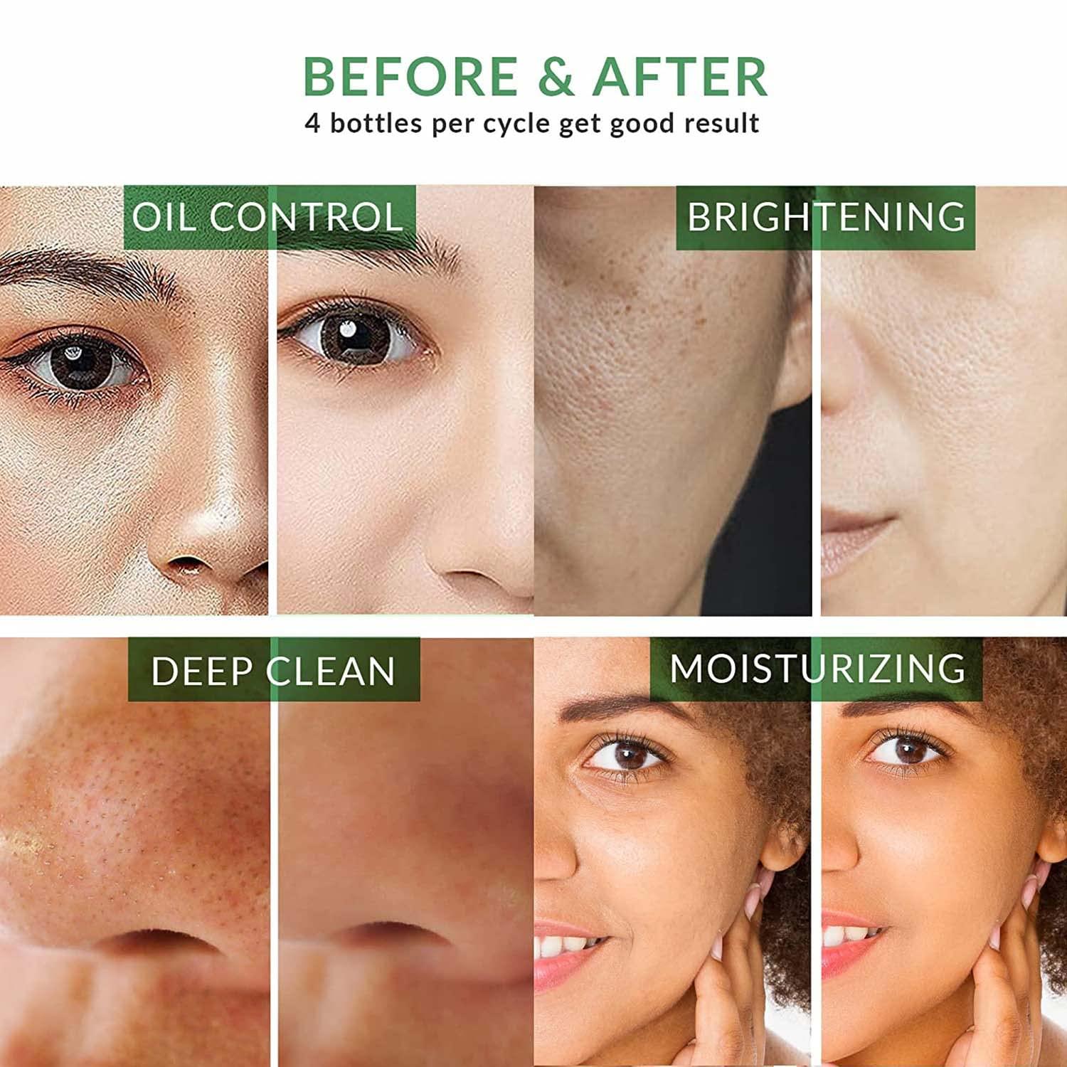 Before and after effects of a skincare product on various skin types.
